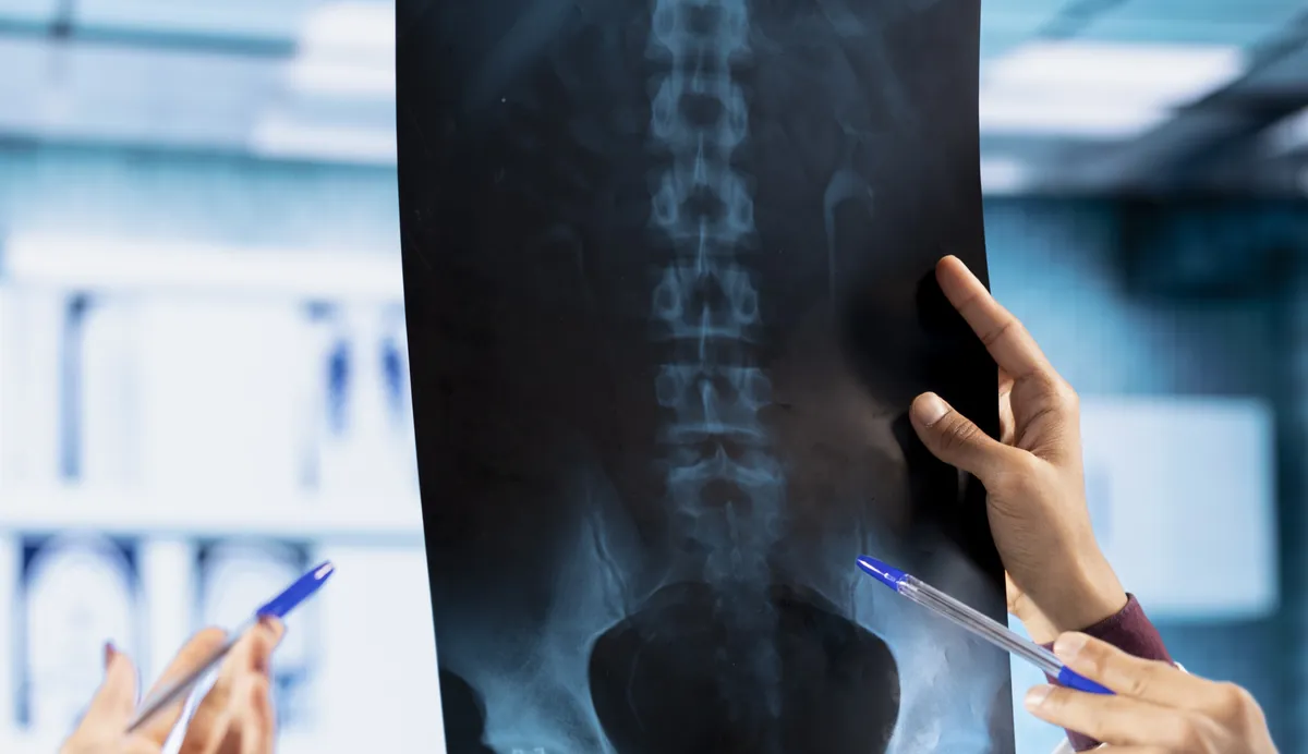 Spine MRI scan displayed for review